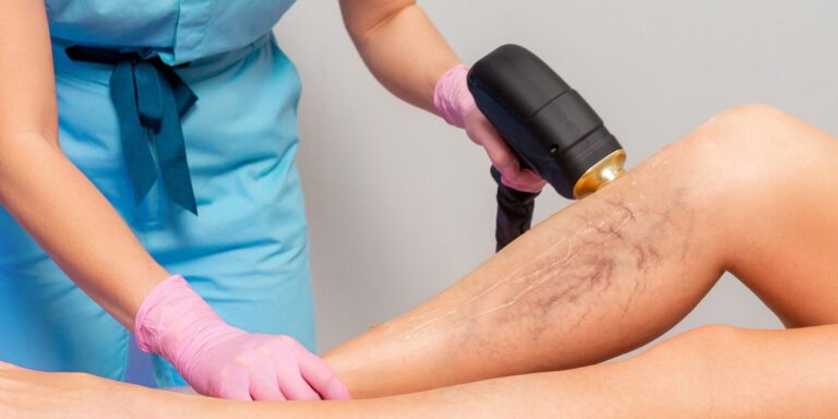 Vein screening