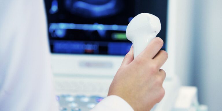 doctor holding an ultrasound scanner to check vascular issues