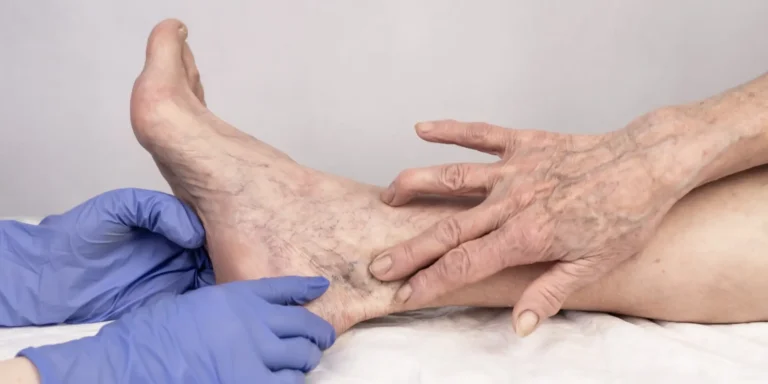 patient showing where she needs sc
