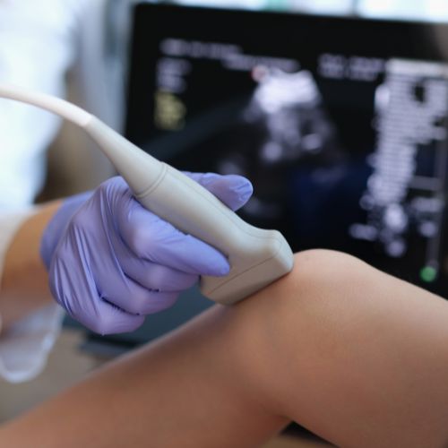 doctor checking for vascular issues using ultrasound