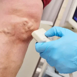 vascular surgeon examining a patient’s varicose vein