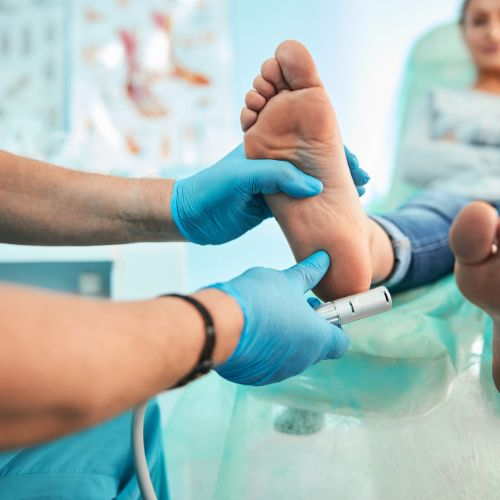 doctor examining his patient for plantar fasciitis