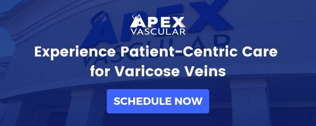 When to worry about varicose veins
