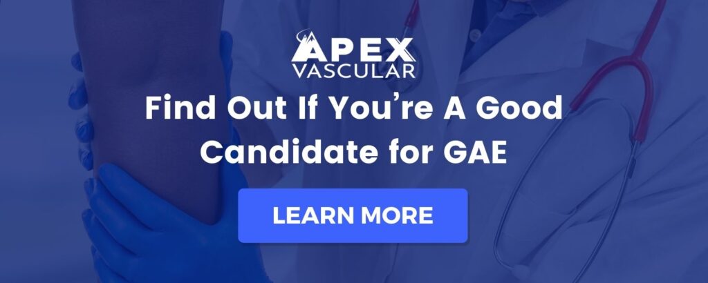 Best Vein Clinic in Knoxville, TN