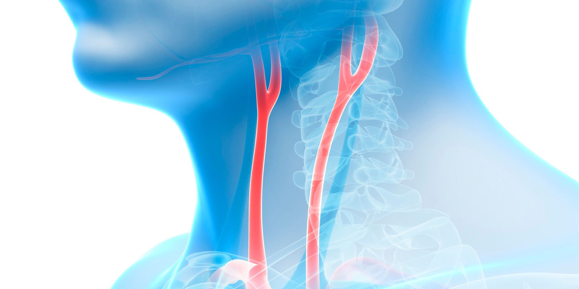 Computer illustration of the human carotid artery