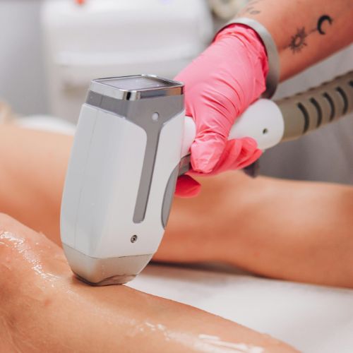 patient recieving vasculaze treatment for varicose veins