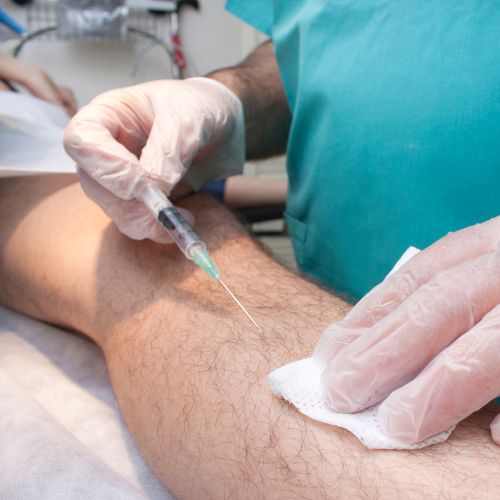 vascular surgeons performing musculoskeletal embolization on a patient