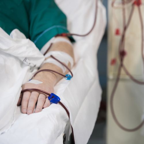 Man lying in hospital bed undergoing dialysis