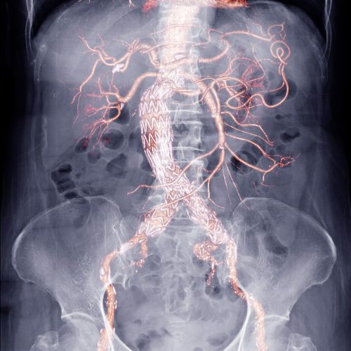 X-ray of an abdomen
