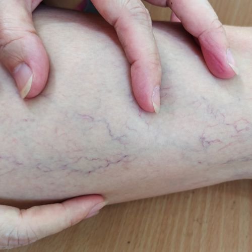 close-up of hands on a leg examining its veins