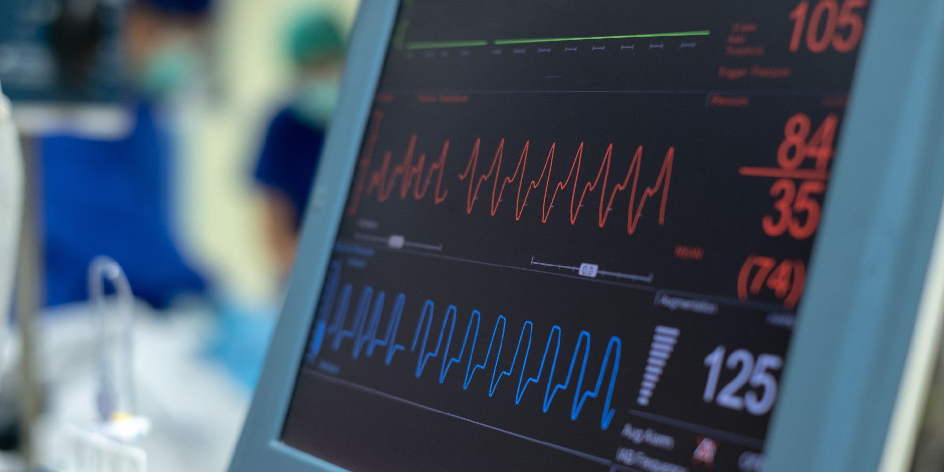 EKG monitor in intra aortic balloon pump machine