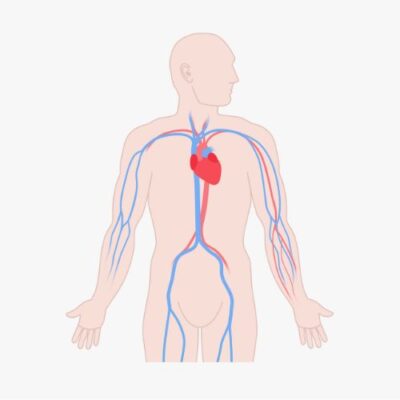 artistic rendering of veins experiencing a blockage, contributing to peripheral artery disease