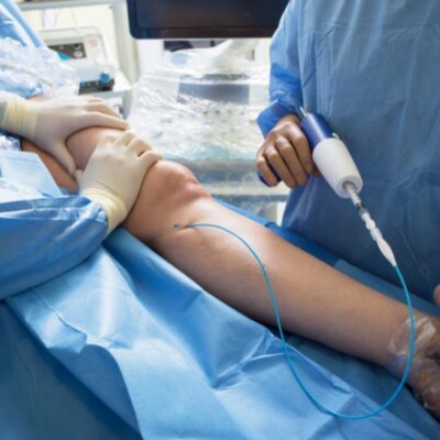 vein doctor performing varicose vein treatment