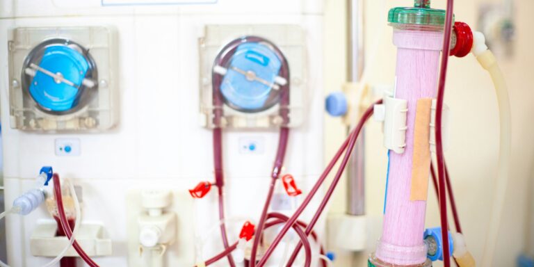 front view of a dialysis machine