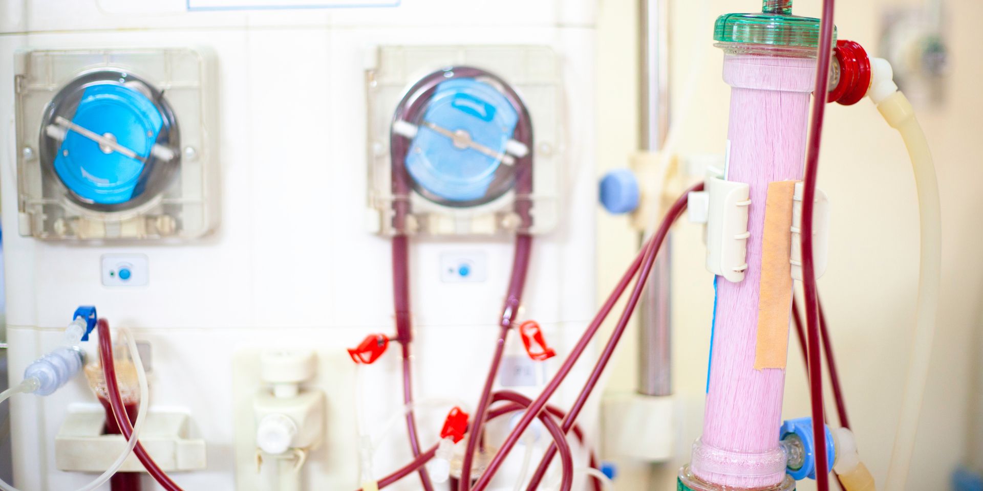 front view of a dialysis machine