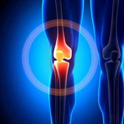 artistic rendering of a leg with knee pain highlighted